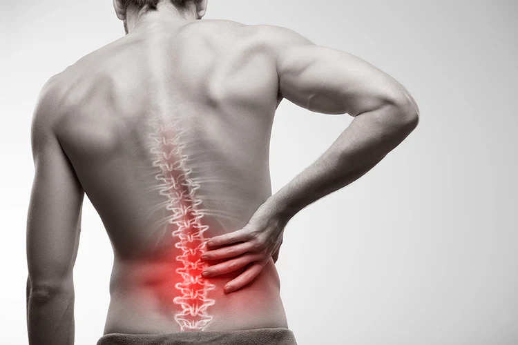 Causes of Back Pain