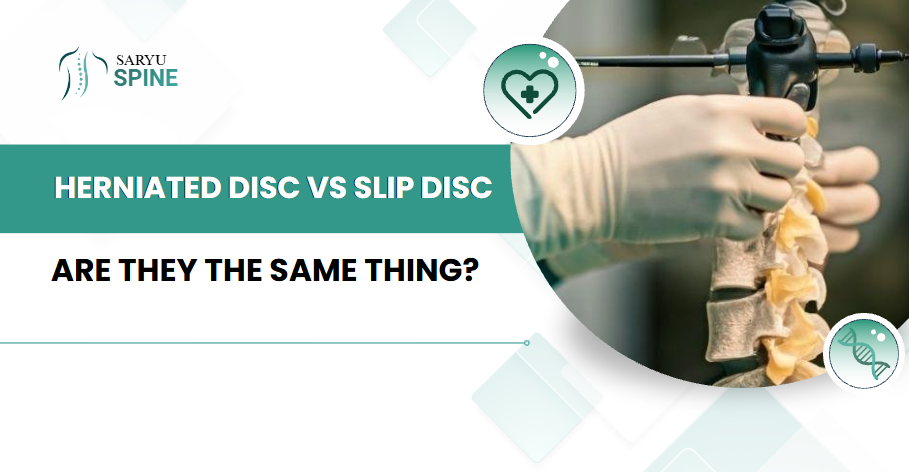 Herniated Disc vs Slip Disc