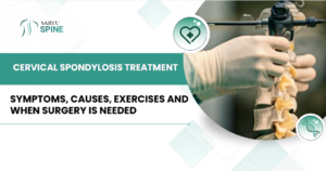 Cervical Spondylosis Treatment