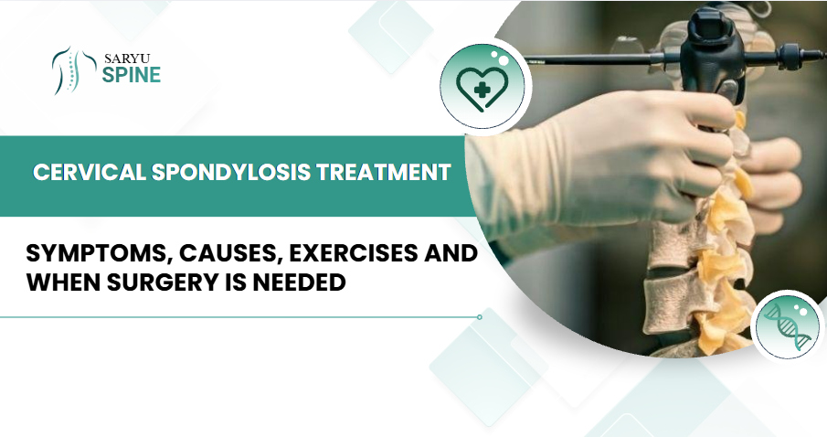 Cervical Spondylosis Treatment