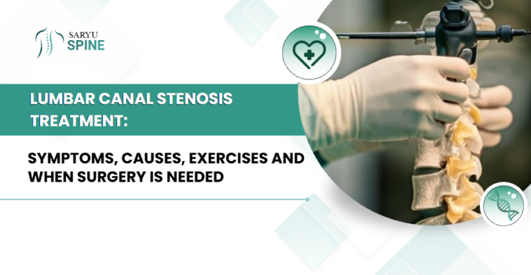 Lumbar Canal Stenosis Treatment