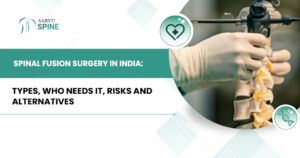 Spinal Fusion Surgery in India: